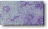 trypanosomes3.jpg (6750 octets)